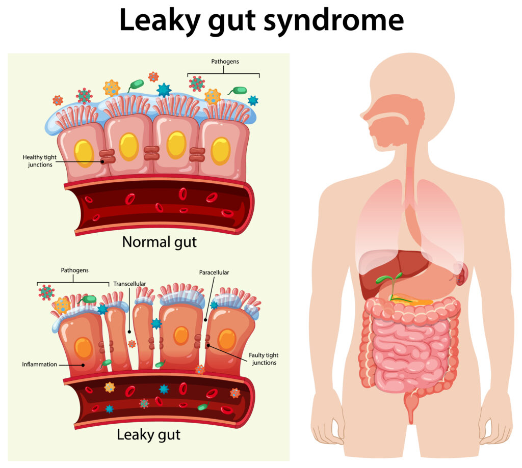 7 Proven Ways to Improve Gut Health Naturally for Better Digestion 3 5651fddc b959 4bab a87c b3e737718e9f 1